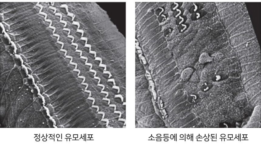 이명/난청 치료방법에 따른 예상치효율